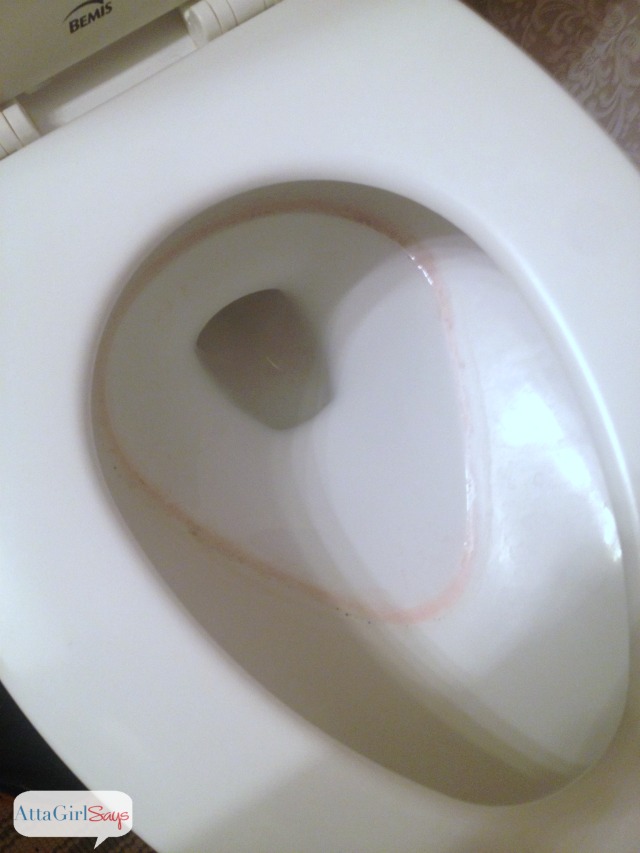 Red Stains Under Toilet Seat